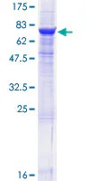 SDS-PAGE - Recombinant Human CD39 protein (GST tag N-Terminus) (AB114445)