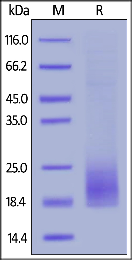 SDS-PAGE - Recombinant Human CD3D protein (AB167701), expandable thumbnail
