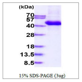 SDS-PAGE - Recombinant Human CD3D protein (His tag) (AB270575), expandable thumbnail