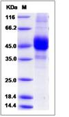 SDS-PAGE - Recombinant Human CD3D protein (Tagged) (AB276346)