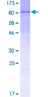 Recombinant Human CD42b protein
