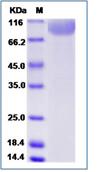 SDS-PAGE - Recombinant Human CD42b protein (His tag) (AB276431), expandable thumbnail