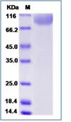 SDS-PAGE - Recombinant Human CD42b protein (His tag) (AB276431)