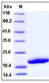 SDS-PAGE - Recombinant Human CD42c/GP1BB protein (His tag) (AB276310), expandable thumbnail