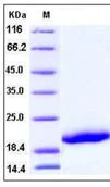 SDS-PAGE - Recombinant Human CD42c/GP1BB protein (His tag) (AB276310)