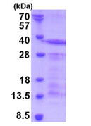 SDS-PAGE - Recombinant Human CD43 protein (His tag N-Terminus) (AB171717)