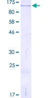 SDS-PAGE - Recombinant Human CD44 protein (AB158063)
