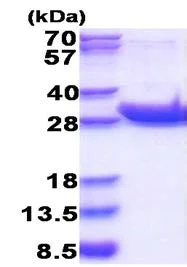 SDS-PAGE - Recombinant Human CD45 protein (AB177717)
