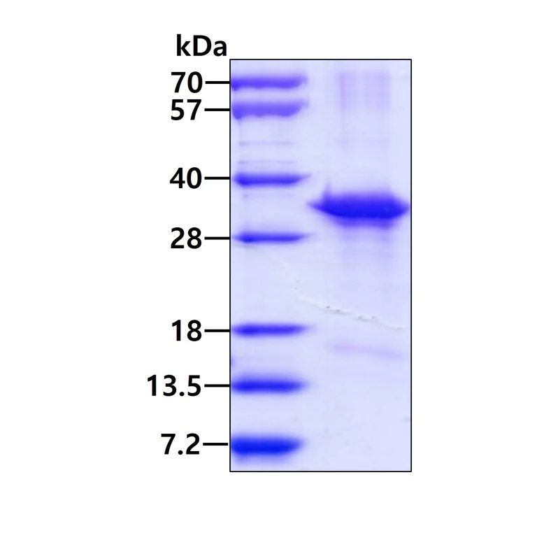 SDS-PAGE - Recombinant Human CD45 protein (His-DDDDK tag N-Terminus) (AB177717)