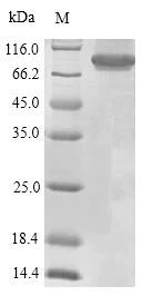 SDS-PAGE - Recombinant Human CD45 protein (Tagged) (AB236938)