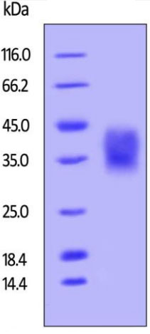 SDS-PAGE - Recombinant human CD47 protein (Active) (AB220594), expandable thumbnail