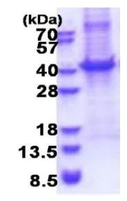 SDS-PAGE - Recombinant Human CD5 protein (denatured) (His tag N-Terminus) (AB180322)