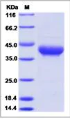 SDS-PAGE - Recombinant Human CD52 protein (Fc Chimera) (AB276636)