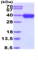 SDS-PAGE - Recombinant Human CD52 protein (Fc Chimera His Tag) (AB229360)