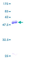 Recombinant Human CD58 protein