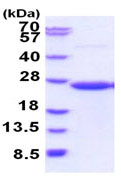 SDS-PAGE - Recombinant Human CD58 protein (denatured) (AB187438)
