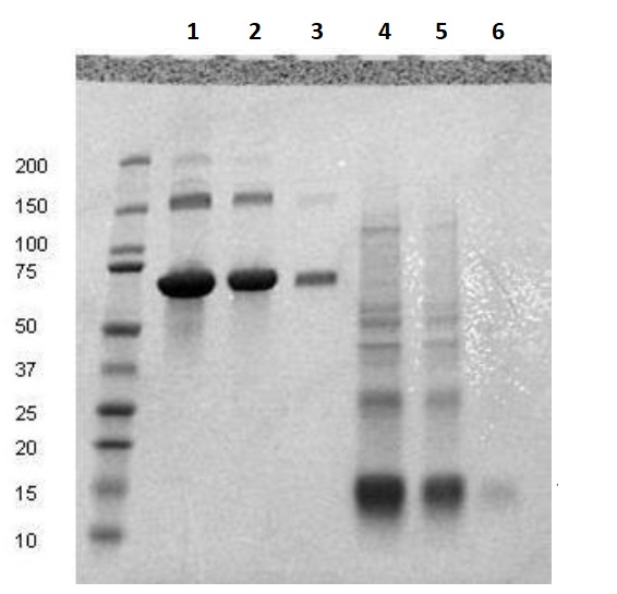 SDS-PAGE - Recombinant Human CD59 protein (AB134887), expandable thumbnail