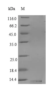 SDS-PAGE - Recombinant Human CD59 protein (His tag) (AB240856)