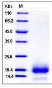 SDS-PAGE - Recombinant Human CD59 protein (His tag) (AB276482), expandable thumbnail