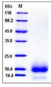 SDS-PAGE - Recombinant Human CD59 protein (His tag) (AB276482)