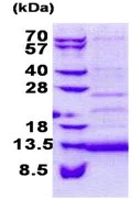 SDS-PAGE - Recombinant Human CD59 protein (His tag N-Terminus) (AB168079)