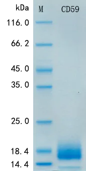 SDS-PAGE - Recombinant Human CD59 Protein Standard (His tag) (AB316435)