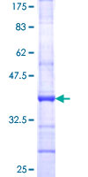 Recombinant Human CD6/T12 protein