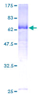 SDS-PAGE - Recombinant Human CD62L protein (AB132972), expandable thumbnail