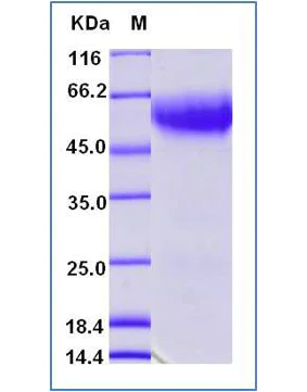 SDS-PAGE - Recombinant Human CD62L protein (His tag) (AB276437)
