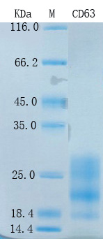 Recombinant Human CD63 Protein Standard (His tag)