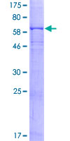 SDS-PAGE - Recombinant Human CD64 protein (AB114416), expandable thumbnail