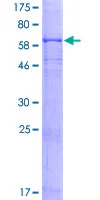SDS-PAGE - Recombinant Human CD64 protein (GST tag N-Terminus) (AB114416)
