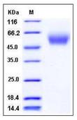 SDS-PAGE - Recombinant human CD66b protein (His tag) (AB276425), expandable thumbnail