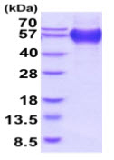 SDS-PAGE - Recombinant Human CD68 protein (His tag) (AB219431)