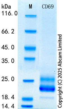 SDS-PAGE - Recombinant Human CD69 Protein Standard (His tag) (AB316536)