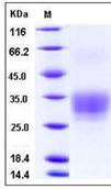 SDS-PAGE - Recombinant human CD7 protein (His tag) (AB276352), expandable thumbnail