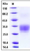 SDS-PAGE - Recombinant human CD7 protein (His tag) (AB276352)