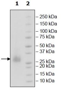 Recombinant human CD70 protein (Active)