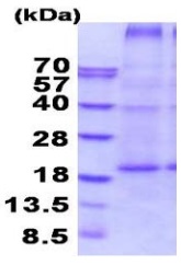 SDS-PAGE - Recombinant Human CD70 protein (denatured) (AB202179)
