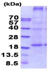 SDS-PAGE - Recombinant Human CD70 protein (denatured) (AB202179)