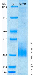 SDS-PAGE - Recombinant Human CD70 Protein Standard (His tag) (AB320812), expandable thumbnail