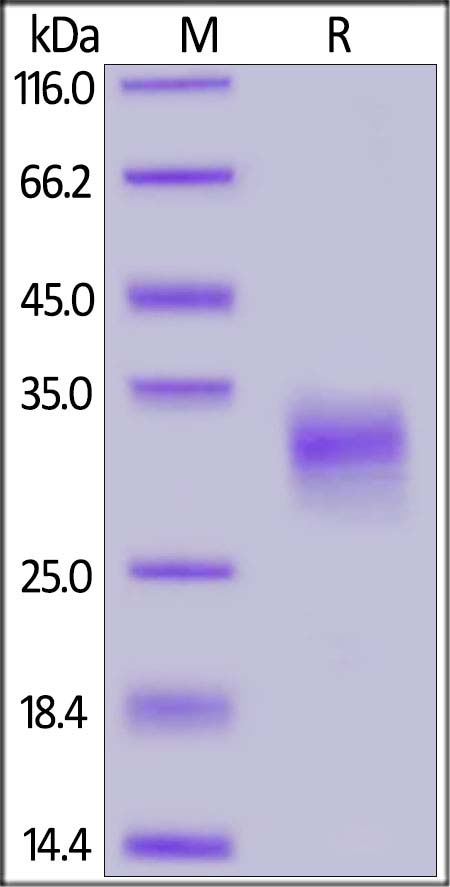 SDS-PAGE - Recombinant Human CD74 protein (His tag) (AB174039), expandable thumbnail