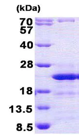 SDS-PAGE - Recombinant Human CD74 protein (His tag N-Terminus) (AB156328)