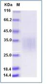 SDS-PAGE - Recombinant Human CD79a protein (His tag) (AB276512)