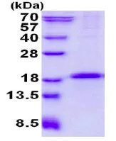 SDS-PAGE - Recombinant Human CD79b protein (denatured) (His tag N-Terminus) (AB137157)
