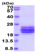 SDS-PAGE - Recombinant Human CD79b protein (His tag) (AB219486), expandable thumbnail
