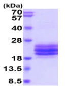 SDS-PAGE - Recombinant Human CD79b protein (His tag) (AB219486)