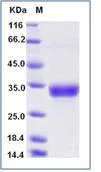 SDS-PAGE - Recombinant Human CD8 alpha + CD8B protein (Tagged) (AB277034)