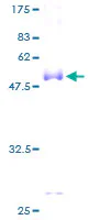 SDS-PAGE - Recombinant Human CD8 alpha protein (GST tag N-Terminus) (AB158045)