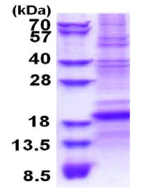 SDS-PAGE - Recombinant Human CD8 beta protein (denatured) (AB177613)